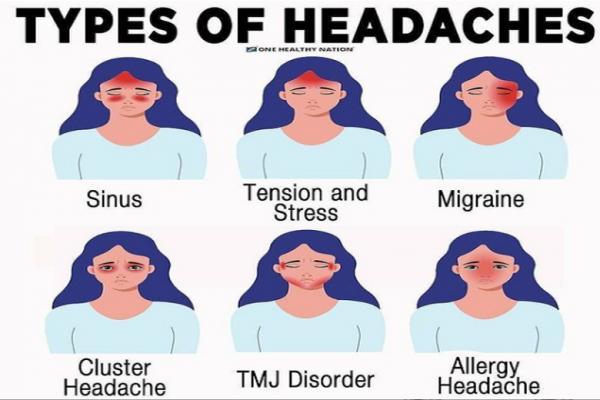 چند نوع سردرد وجود دارد؟